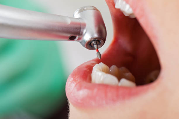 Best Emergency Dental Extractions in Blackwood, NJ